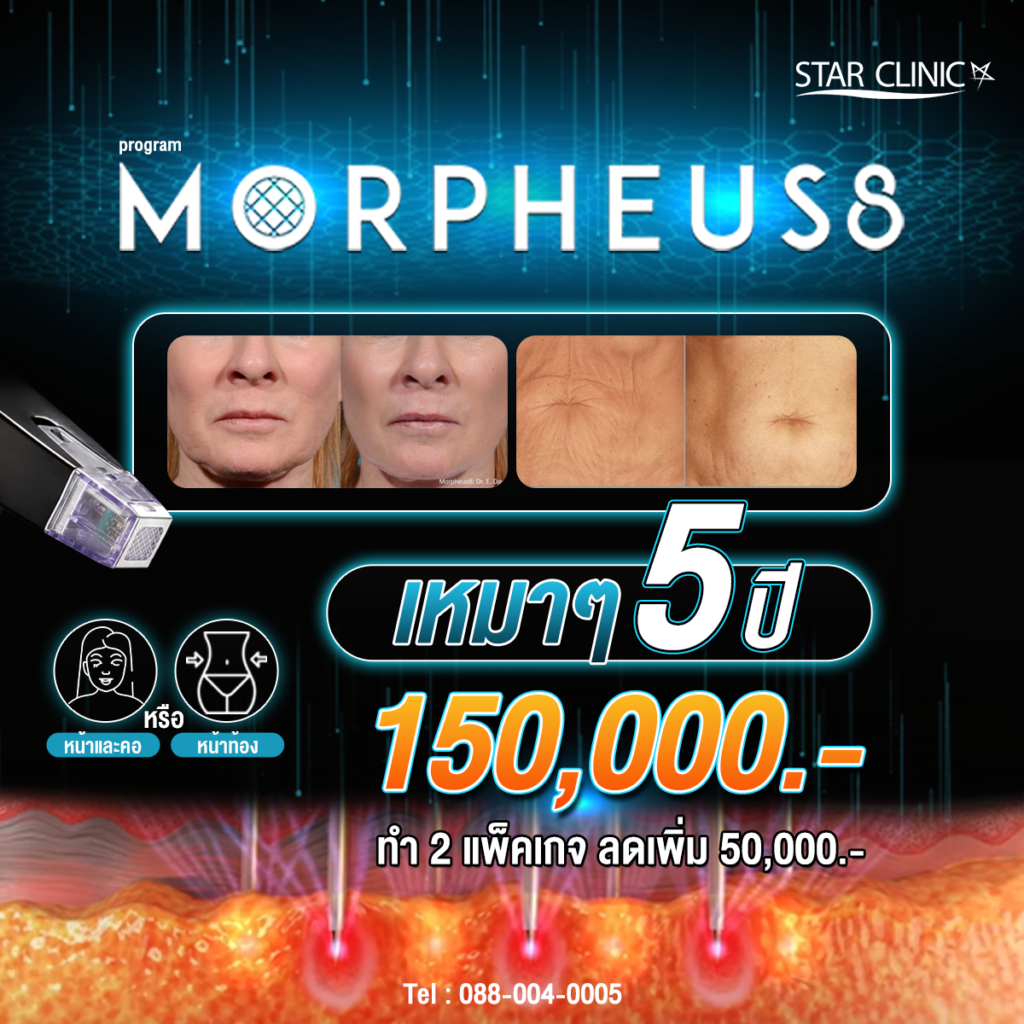 Morpheus8 บอกลาผิวยับให้ผิวกลับมาเฟียส เหมาๆ 5 ปี